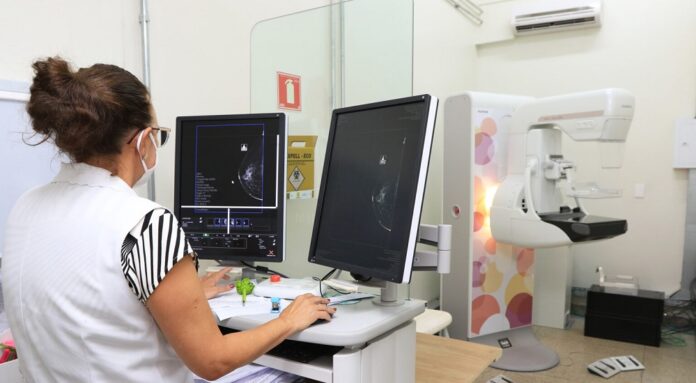 Outubro Rosa DF triplica exames e reduz fila para mamografia em 80%