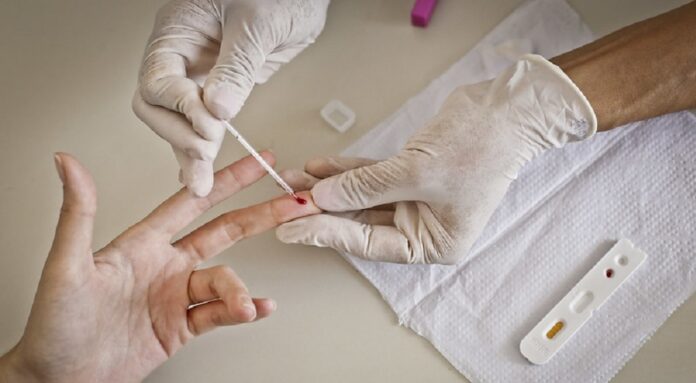 Com testagem e tratamento imediato, DF reduz mortes por HIV em 21,6%