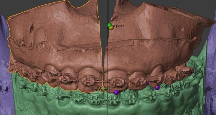 A unidade realiza procedimentos essenciais para a recuperação estética e funcional dos pacientes, incluindo cirurgias de internação facial e atendimentos de emergência.