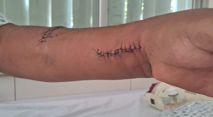 Homem diz ser atacado por cães em casa de influenciador no DF